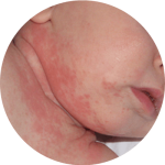 SKINLABS - Dr.Ridz SkinLabs - Dermcare