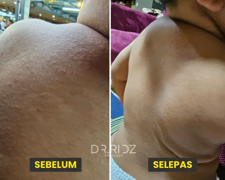 RUAM BADAN
